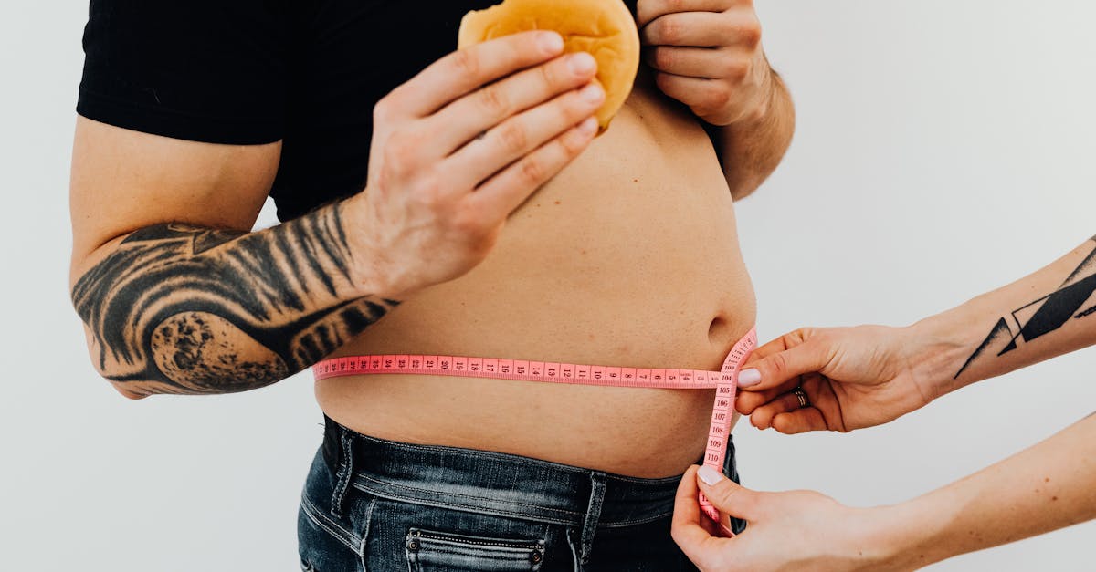 Congresso SIO: rivoluzione nel trattamento dell’obesità