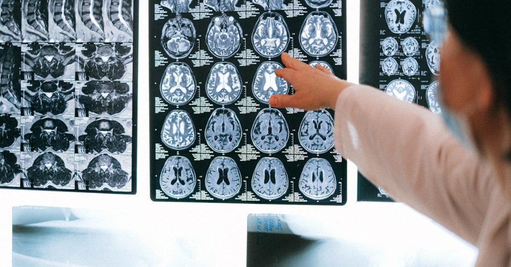 Radiologist pointing at brain MRI scans showing detailed medical examination.